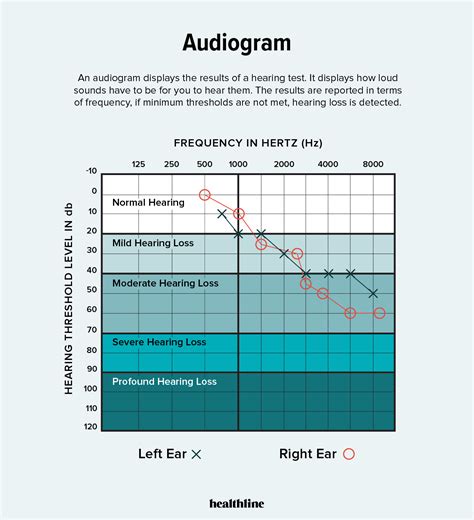 how to read speech audiometry results|How to Read an Audiogram: Graph, Symbols, and Results .